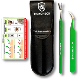 TickCheck Premium Tick Remover Kit
